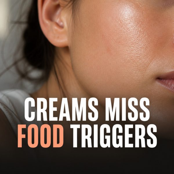 Your Eczema Creams Are Missing the Trigger eczema food triggers