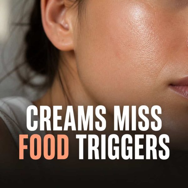 eczema food triggers